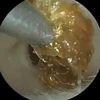 EarsUnplugged