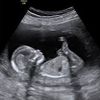 First Glimpse Ultrasound