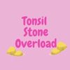 Tonsil Stone Overload